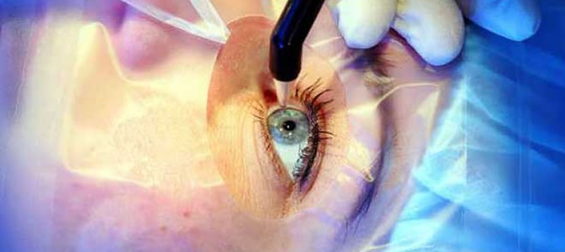 Cornea-Transplant / Topography Department